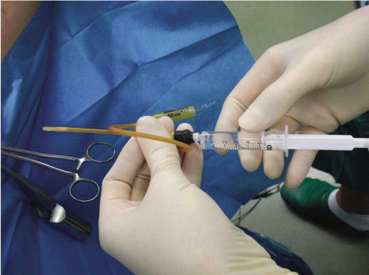 Infertility specialist in Jayanagar 9th Block